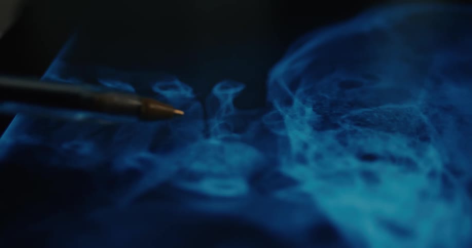 Pen points at places on an x ray of a skull