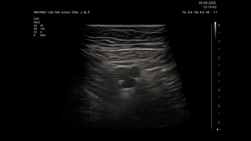 A medical ultrasound screen displays black and white grainy images of internal body tissues with data and timestamps shown at the top and sides
