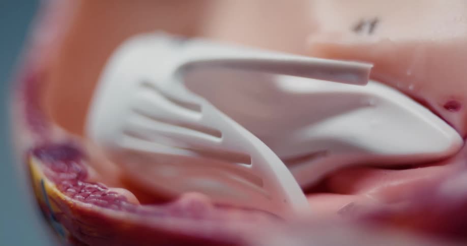 Anatomical model with muscular and vascular structures
