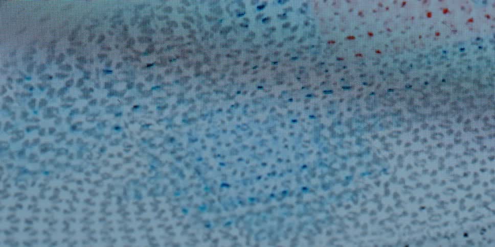 A pixelated close-up of a digital screen reveals a scientific image of stained biological cells
