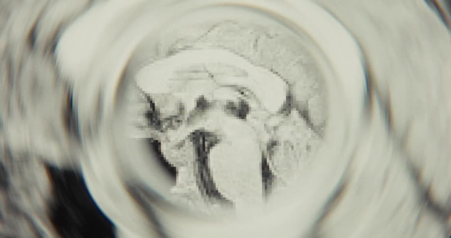A surreal journey through the human mind is visualized as an animated, distorted MRI brain scan