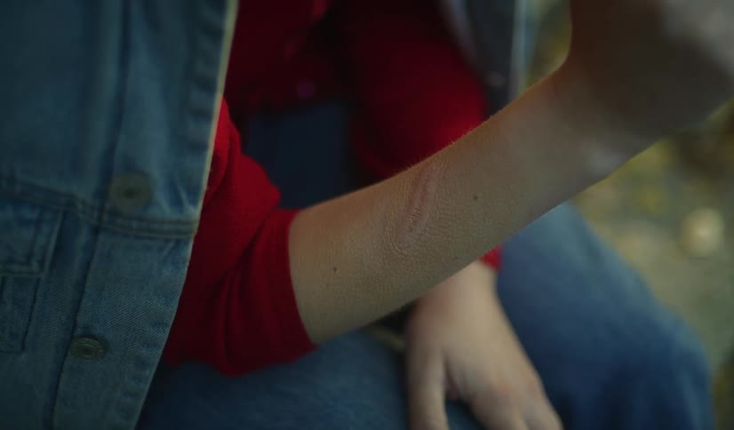 A somber close-up view reveals healed self-harm scars on a person's arm