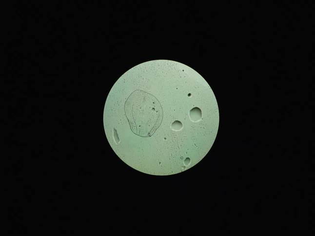 A scientific view through a microscope reveals a world of microorganisms and air bubbles in a liquid sample