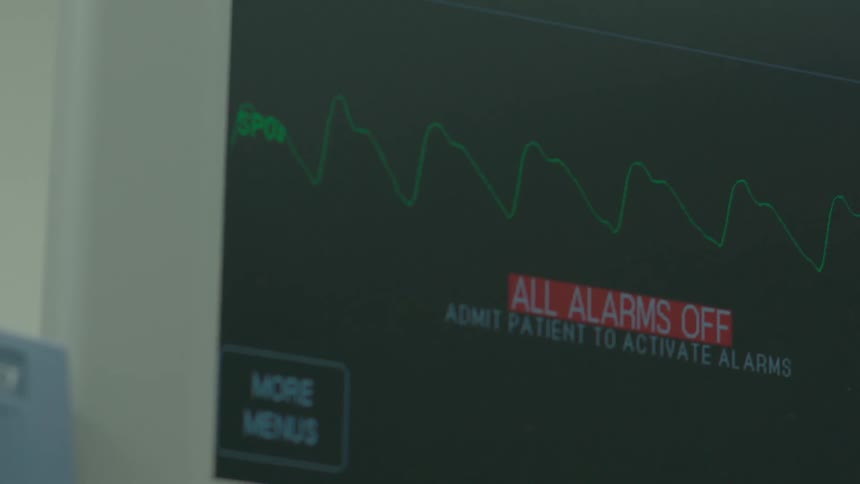 A slow pan across medical monitoring equipment showing a patient's vital signs and alarms in a hospital room