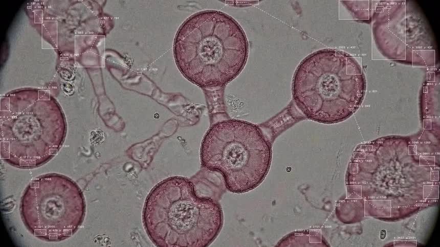An AI vision system identifies and tracks biological cells as they multiply under a microscope