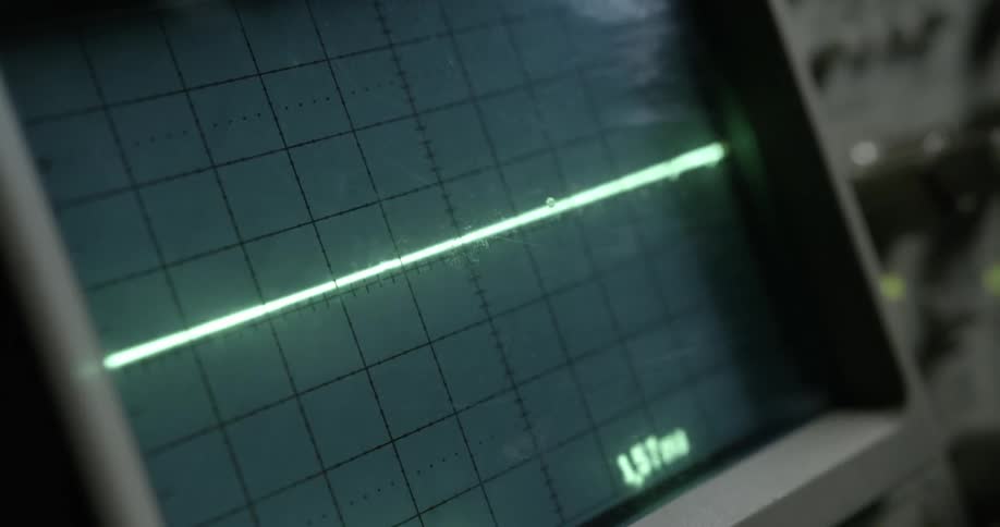 Medical equipment flashes lines across its screen