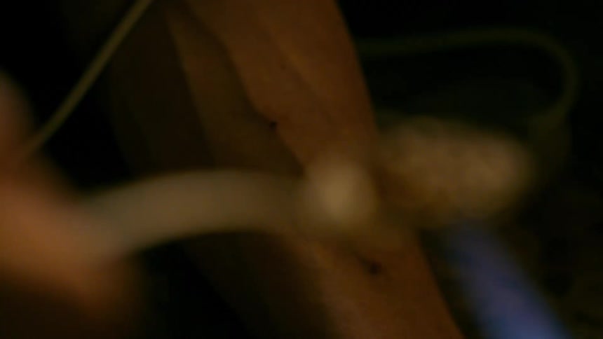 Extreme close-up of a drug user's arm with track marks as they heat a substance with a flame