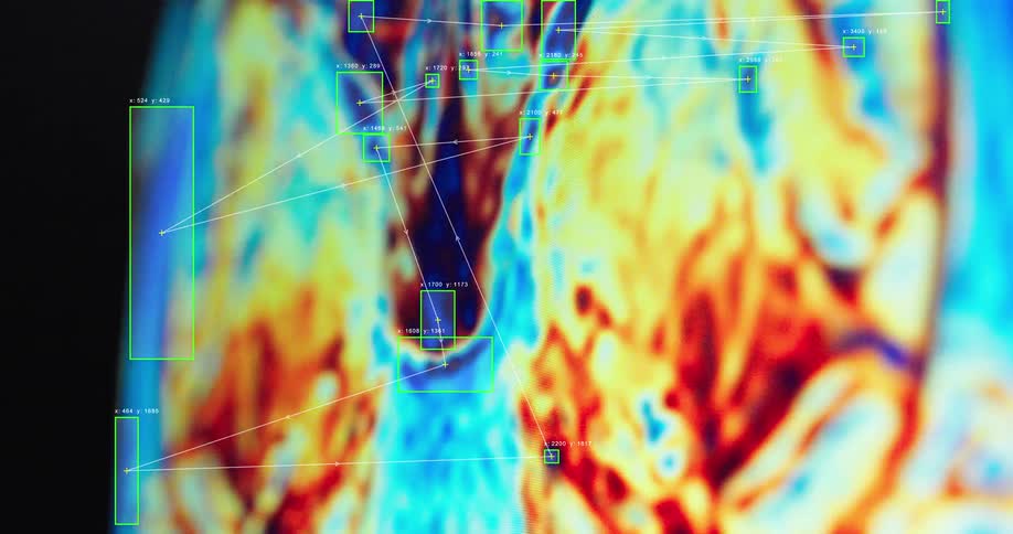 Close-up of advanced AI software analyzing a colorful medical MRI scan with data overlays and tracking points