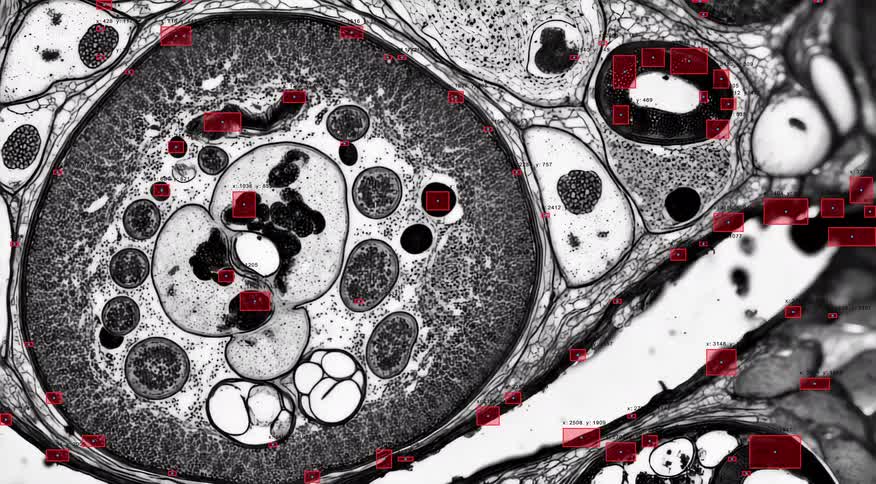 Advanced AI algorithms performing object detection on a microscopic biological sample, identifying cellular structures