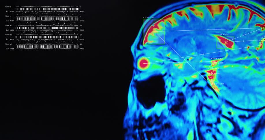 Advanced scientific software analyzes a human brain MRI scan with digital graphics tracking neural pathways alongside genetic data