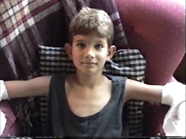 A young boy sits in an armchair with ice packs wrapped around both of his arms, likely recovering from an injury in 1997