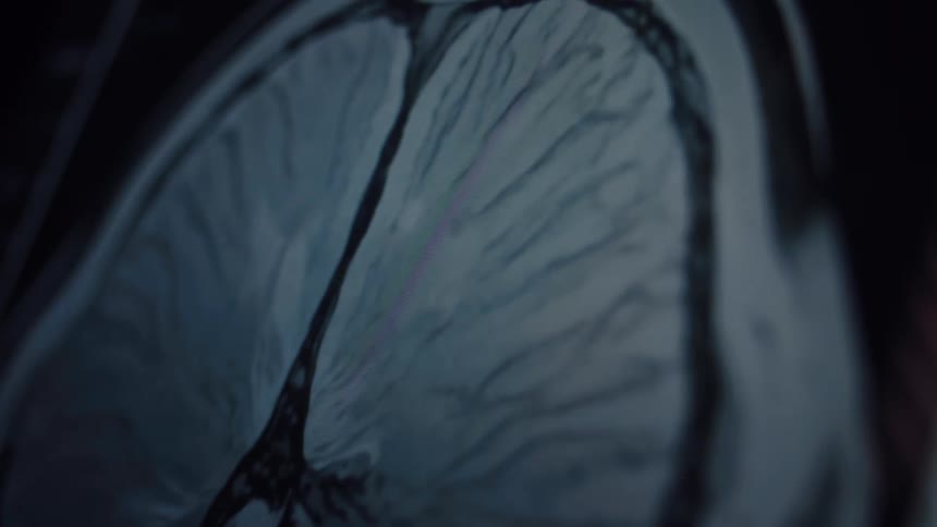 A close-up shot of a cardiac MRI scan shows the rhythmic contractions of a human heart