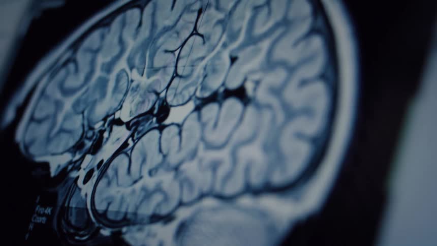 A detailed close-up of a human brain MRI scan moving through different sagittal slices on a digital screen