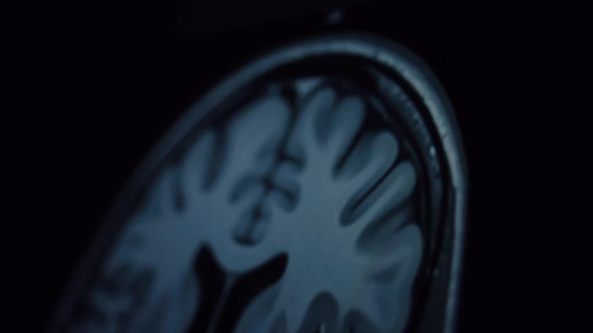 A slow pan across a close-up, out-of-focus MRI scan showing the folds of a human brain