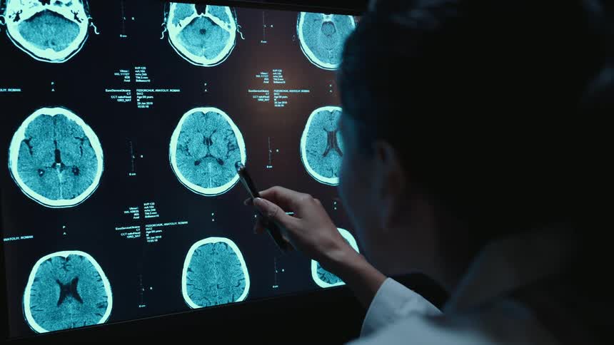 An over-the-shoulder shot of a medical professional analyzing a patient's CT brain scans on a large digital screen