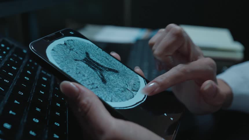 Close-up of a doctor analyzing a CT brain scan on a smartphone in a dark office