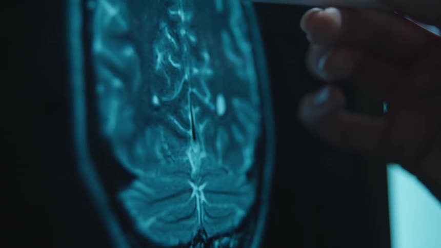 A medical professional uses a stylus to examine a digital MRI brain scan on a tablet screen