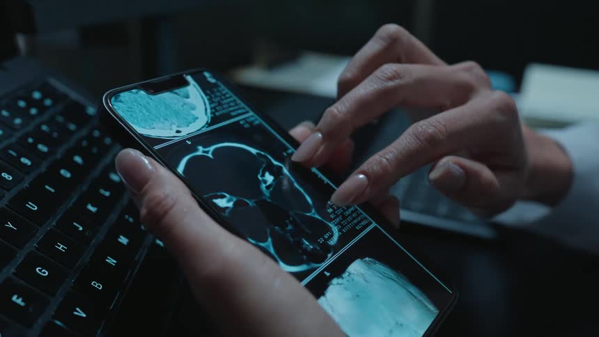 Close-up of a doctor's hands analyzing a patient's MRI brain scan on a smartphone