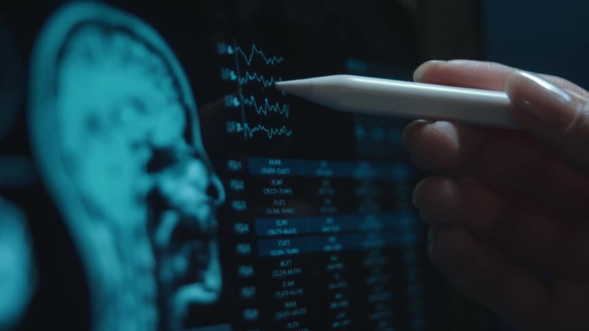 A medical professional uses a stylus to examine a patient's brainwave data alongside an MRI scan on a digital screen