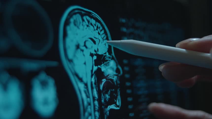 Close-up of a medical professional's hand pointing with a stylus at an MRI brain scan on a digital screen