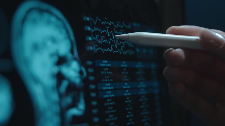 A neurologist uses a stylus to point at an EEG readout next to an MRI brain scan on a digital screen