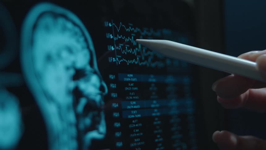 A medical professional points to brain wave patterns on a digital screen showing an MRI scan and patient data