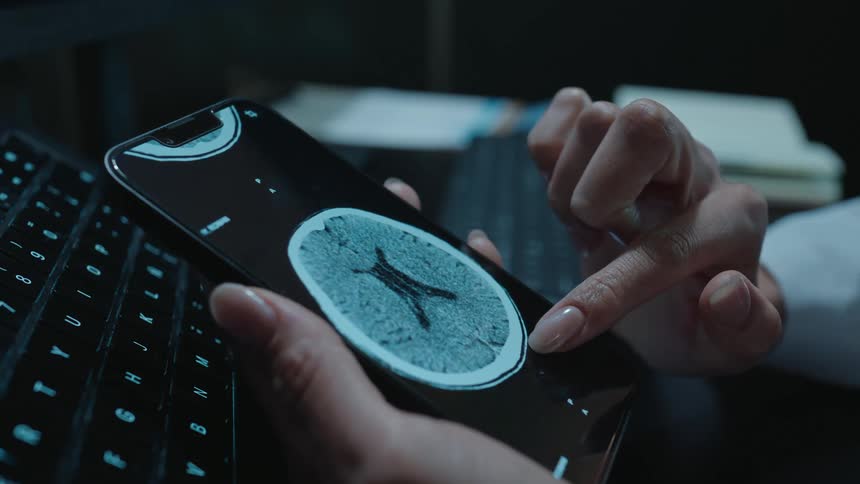 A medical professional uses a smartphone to closely examine a patient's CT brain scan in a dimly lit room