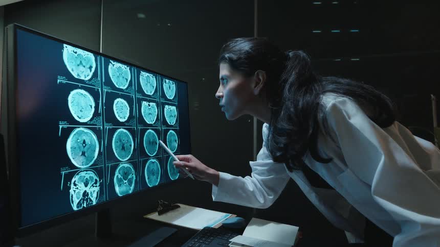 Female doctor in a lab coat meticulously examines a patient's brain CT scans on a large monitor in a dimly lit office