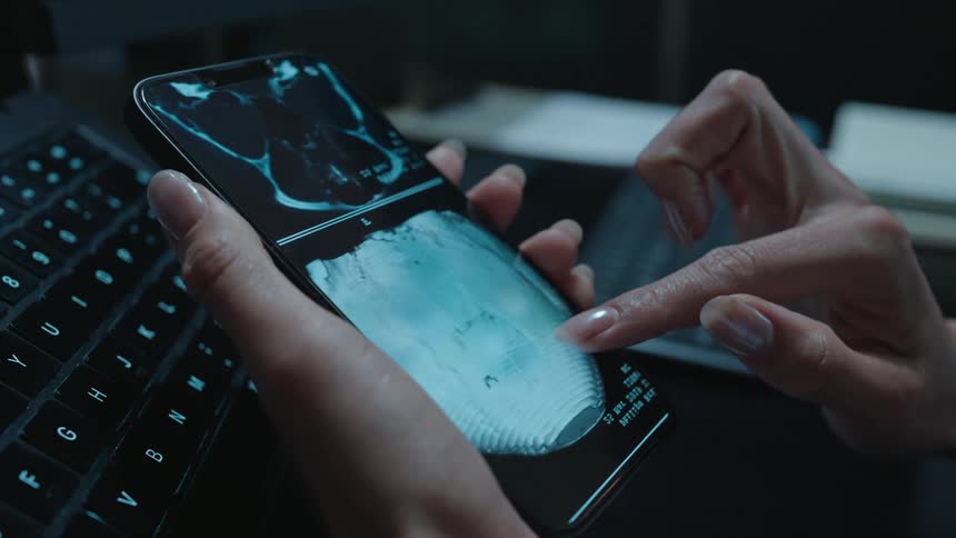 Close-up of a doctor's hands analyzing a digital brain scan on a modern smartphone