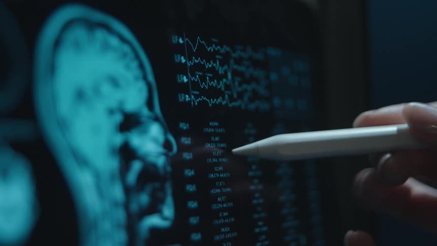A doctor or scientist meticulously analyzes a patient's brain scan and neurological data on a digital screen
