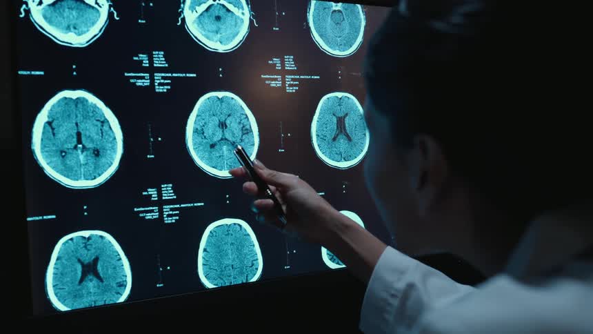 Over-the-shoulder shot of a female doctor examining multiple CT brain scans on a large digital screen in a dark room