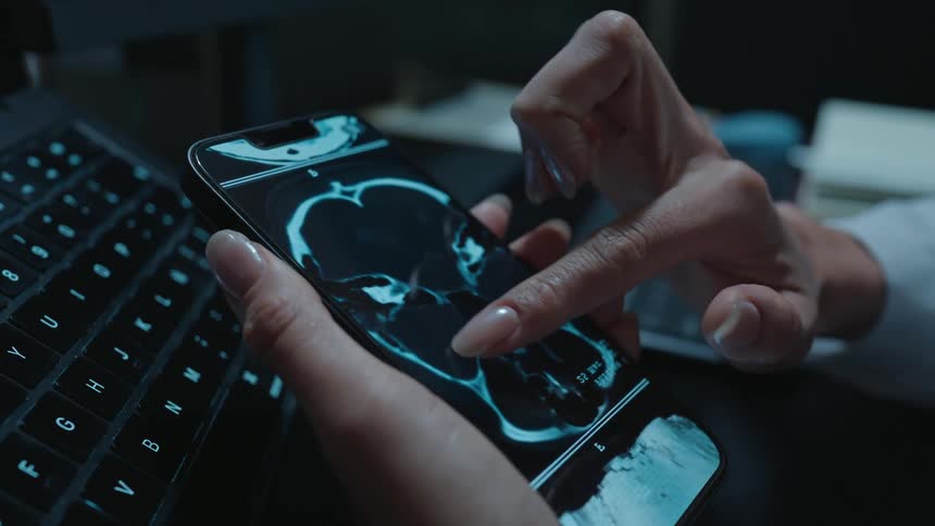 Vertical close-up of a doctor's hands examining a patient's brain CT scan on a smartphone in a dark office