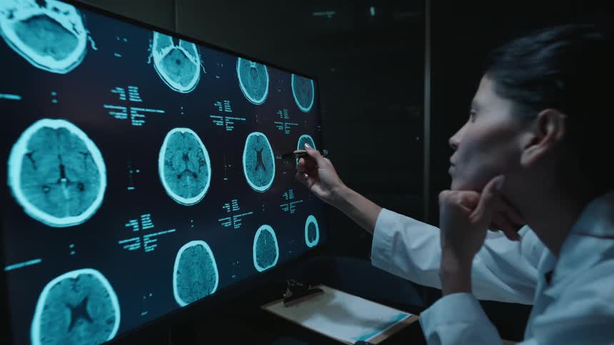 A female doctor in a dark room intently studies a patient's brain CT scan on a large computer monitor