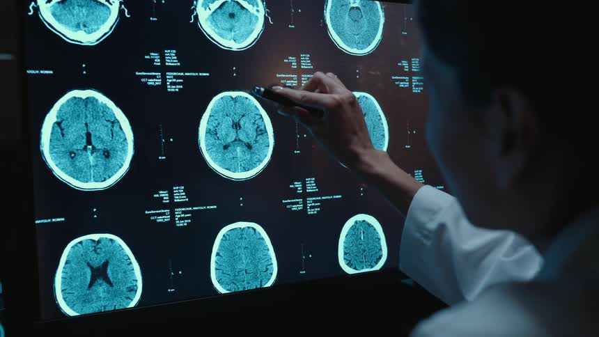 A doctor in a dark room uses a stylus to closely examine multiple brain scans displayed on a large screen