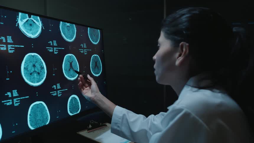 A female doctor meticulously examines a patient's brain scans on a computer monitor in a dimly lit radiology room