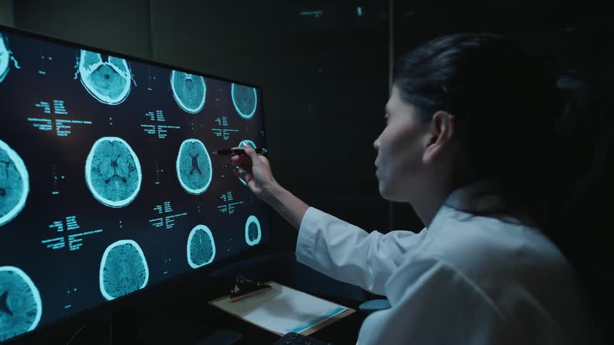 A female doctor in a dark room carefully examines a patient's brain scans on a large computer screen