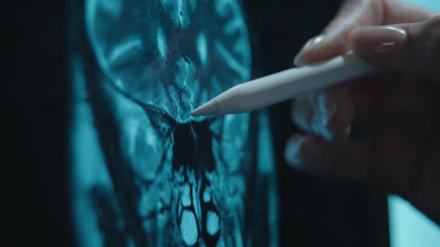 A doctor uses a stylus to point at and analyze a detailed MRI brain scan on a digital screen