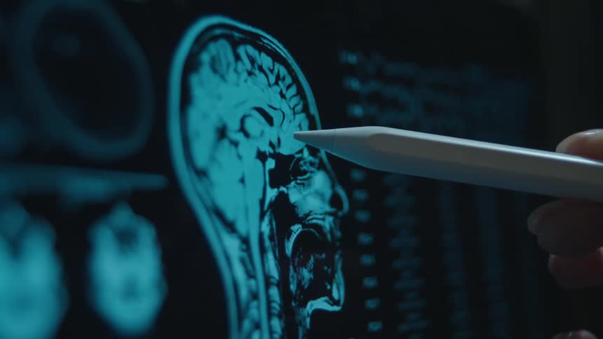 A doctor uses a stylus to analyze a patient's MRI brain scan displayed on a high-tech digital screen