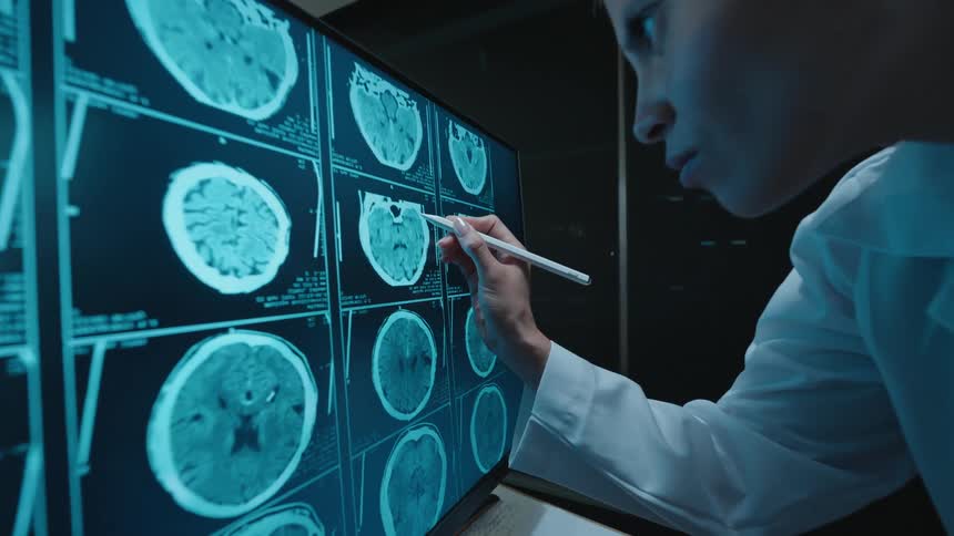 A female doctor meticulously analyzes a patient's brain CT scans on a large digital screen in a modern, dark laboratory