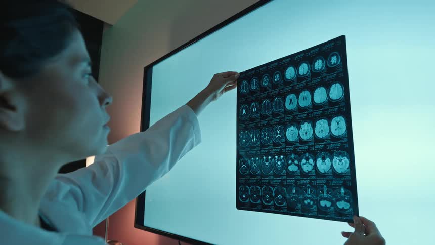 A female doctor in a white coat carefully examines a patient's brain MRI scan against a glowing light screen