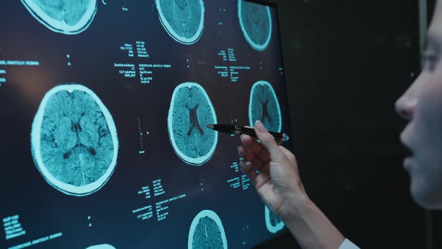 A female doctor points a pen at a large digital screen displaying CT scans of a human brain, carefully analyzing the results