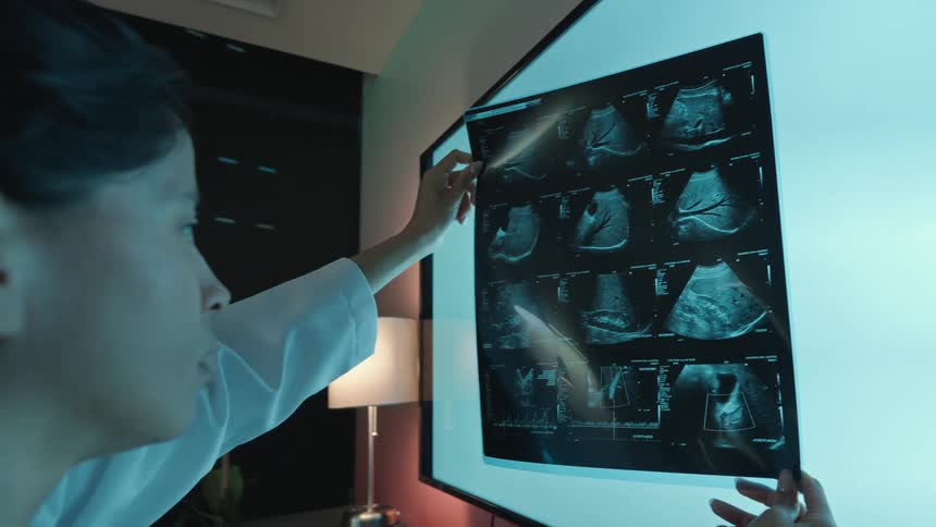 A female doctor carefully studies an abdominal ultrasound scan against a bright light in a dark room