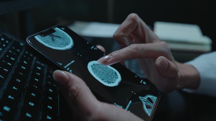 A doctor's hands scroll through and analyze a patient's CT brain scan on a smartphone in a dark office