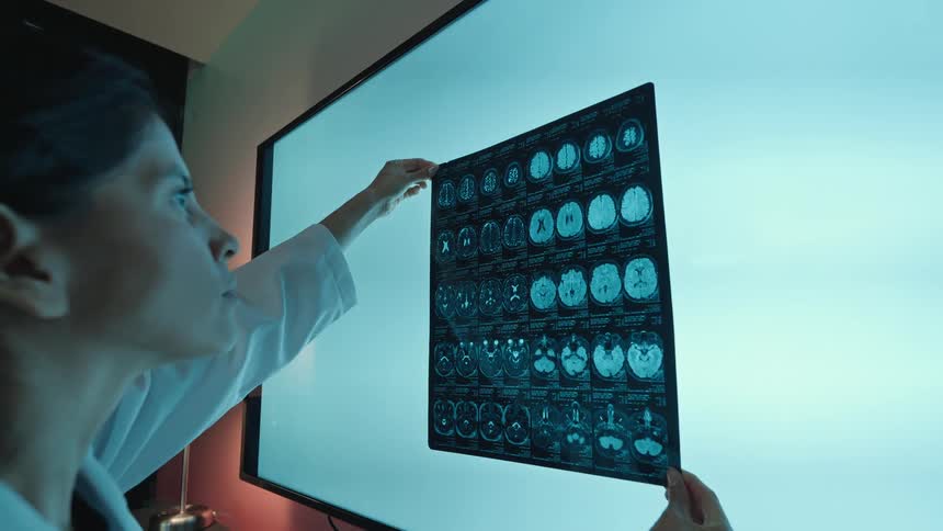 Female doctor in a white lab coat meticulously examines a brain MRI scan against a large, illuminated screen in a dark office