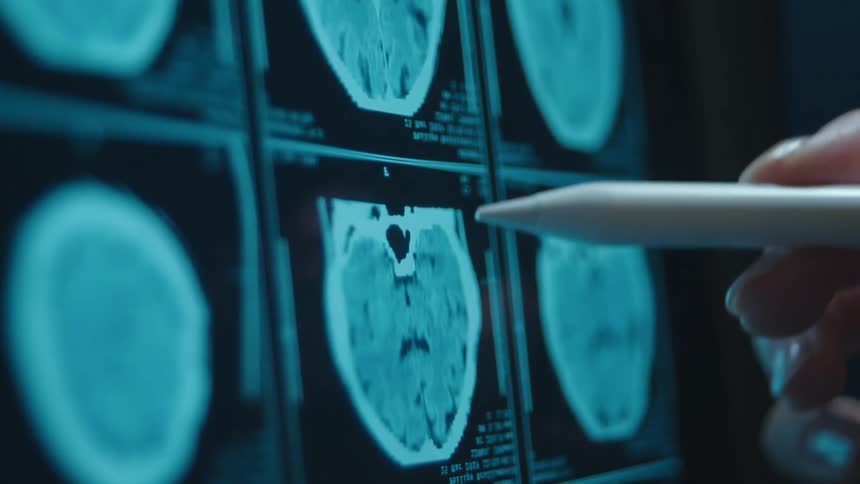 A medical professional carefully examines a CT scan of a human brain on a digital screen using a stylus