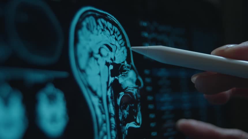 A close-up of a doctor's hand using a stylus to examine a digital MRI brain scan on a tablet