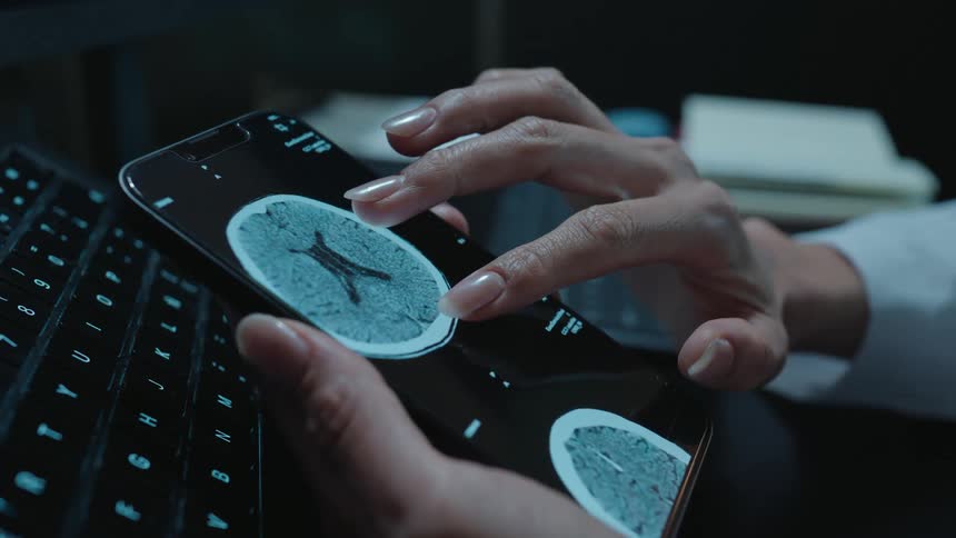 Close up of a doctor's hands analyzing a patient's brain CT scan on a smartphone, zooming in to examine the details