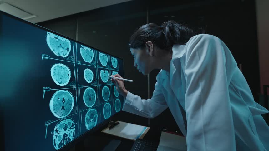 A focused female doctor in a lab coat meticulously examines a patient's brain scans on a large computer monitor