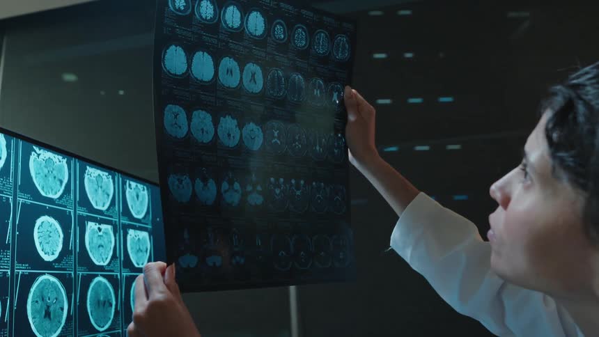A female doctor in a dark room carefully analyzes a patient's brain MRI scan against a digital display