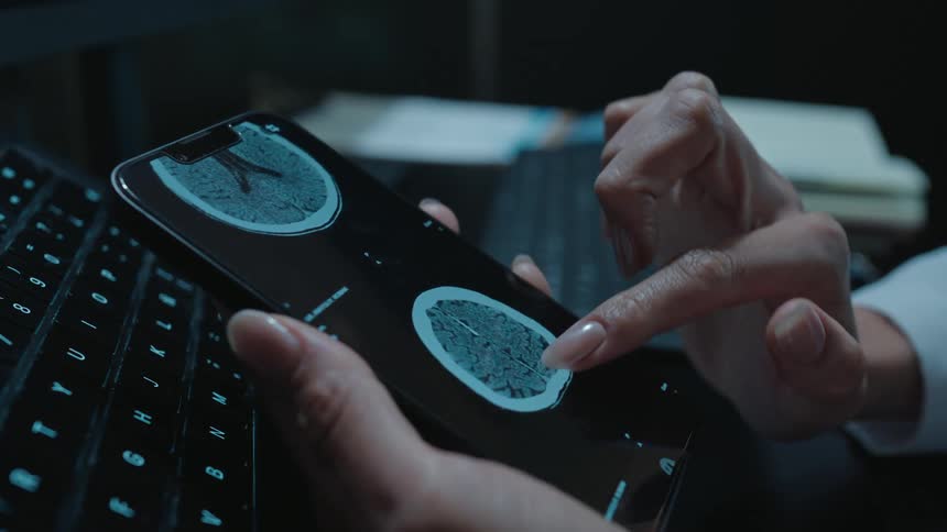A female doctor's hands carefully review a CT scan of a human brain on her smartphone in a dark office